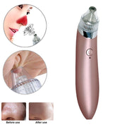 Professional Beauty Facial Machine