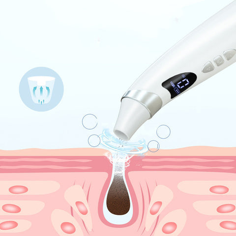 Electric Visual Blackhead Remover