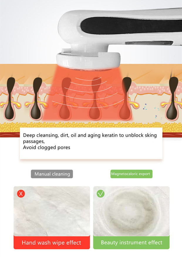 Negative ion skincare device